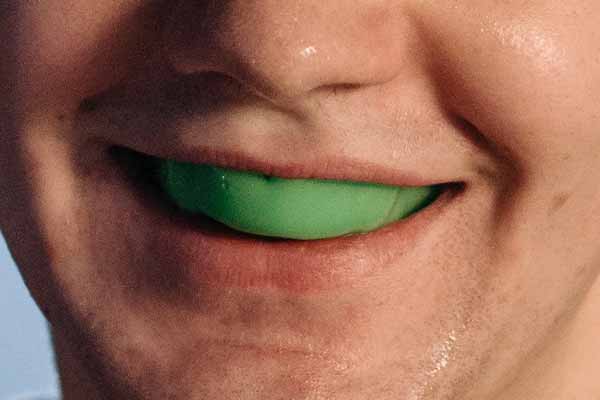 Sports Mouthguards
