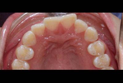 relapse treatment melbourne hawthorn