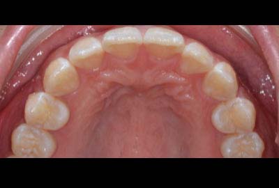 relapse treatment melbourne hawthorn